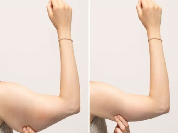 Bài tập bắp tay thon gọn siêu hiệu quả cho nữ